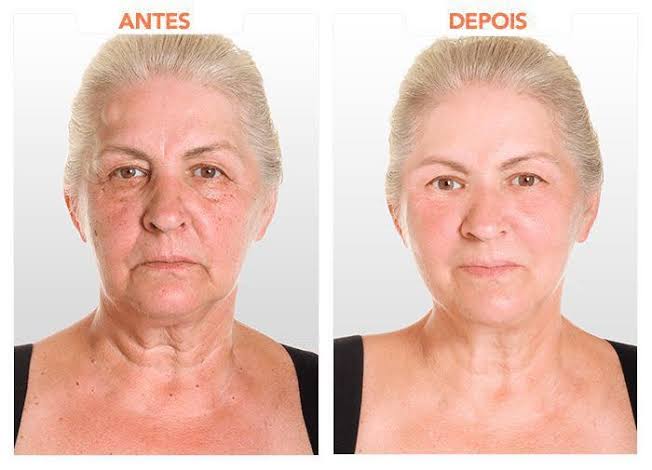 SERUM FACIAL HIDRATANTE CON ACIDO HIALURÓNICO 30ML